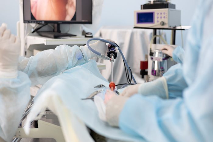 Introduction to Rigid Endoscopy in General Practice