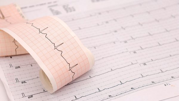 Cardiac Arrhythmias in Practice: From Diagnosis to Management