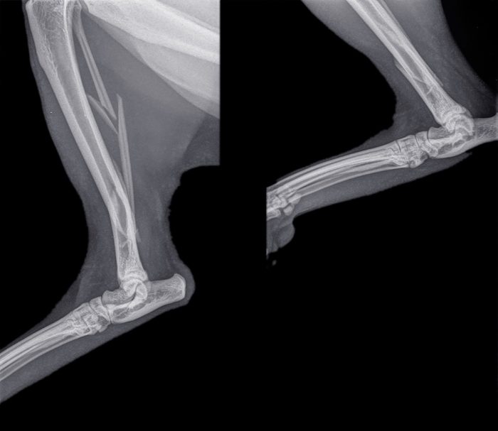 Moving On With Orthopaedics