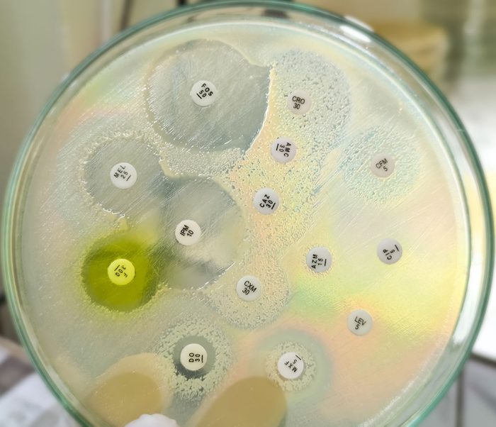 Antimicrobial Stewardship: Rational Decision Making for Antibiotic Usage in General Practice