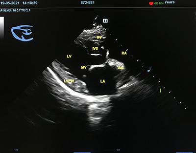 Echocardiographic,Finding,Shows,Right,Parasternal,4,Chambers,View,In,Canine