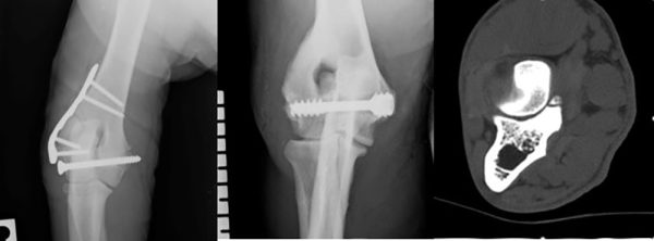Hands-On Lab: Getting to grips with the Elbow