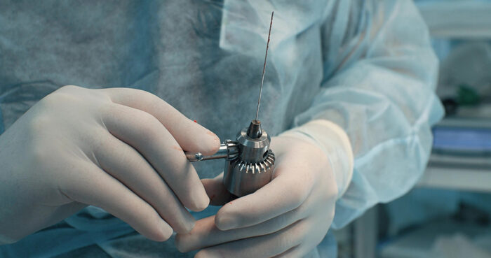 Introduction to Orthopaedic Surgery