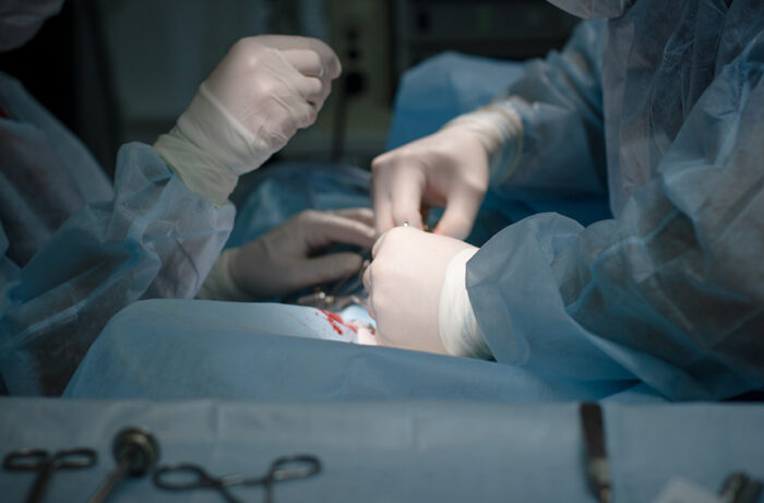 Next Steps in Soft Tissue Surgery